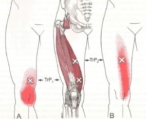 SCAN IMAGE