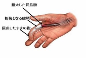 C6CB2430-C828-420A-9C41-38419997B3E3-6005-00000A19AE60CFF1