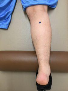 IMG_0036