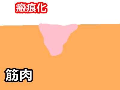 danretu2