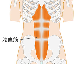 腹 直 筋 押す と 痛い