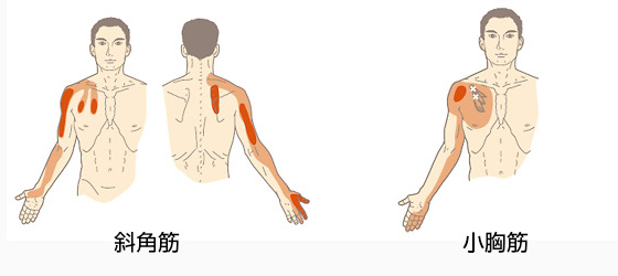 斜角筋と小胸筋のトリガーポイント