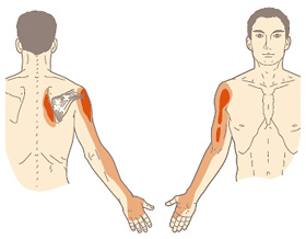 棘下筋が原因の痛みやしびれ 京都平川接骨院 鍼灸治療院グループ