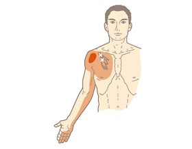 胸 痛み 左 上 左胸上痛みの痛み。至急お願いいたします…もう、一ヶ月以上も、左胸