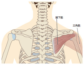 棘下筋が原因の痛みやしびれ 京都平川接骨院 鍼灸治療院グループ