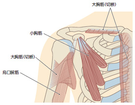 左 胸 した の 痛み