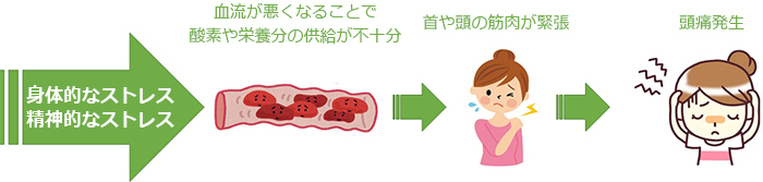 zutsu_mechanism-2